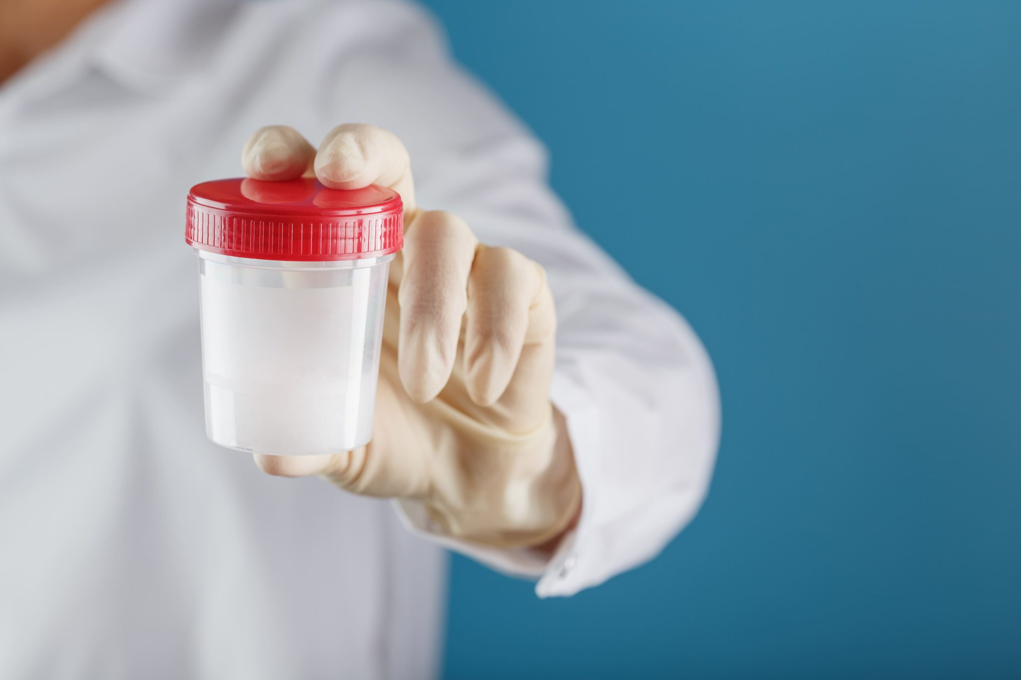 semen-analysis-in-bank-is-held-in-the-hand-of-doctor-infertility-2-scaled-1